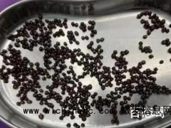 女子体内取出几百颗结石如鱼子酱 这是舍利子雏形