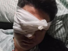 烟花炸伤右眼案已立为刑事案件 肇事者或将面临刑责[推荐]