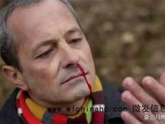 男子爱挖鼻孔致动脉血管破裂 小习惯酿成大祸[推荐]