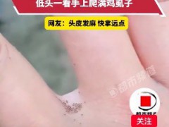 女子鸡圈抓鸡浑身痒疼，低头一看手上爬满鸡虱子[推荐]