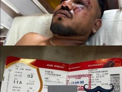 印度警方称坠机事故有1名幸存者 坠毁的客机载有242人!