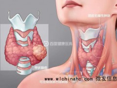 女子长期情绪内耗确诊甲状腺癌 情绪压力成关键因素[推荐]