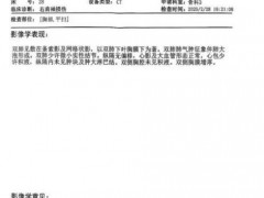 女子被误诊绝症服药3个月 医院回应 翟先生说了什么内容？