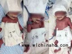 五福临门！24岁女子成功诞下5胞胎，满屏都是软萌幸福感！