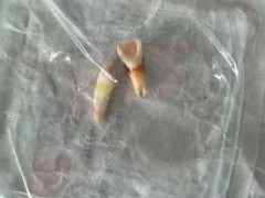 男孩遭母亲同居男友殴打致轻伤二级 施暴者已被刑拘[推荐]